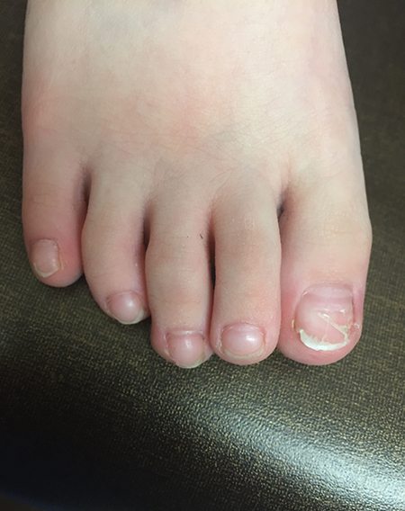 Hand-Foot-Mouth Disease 4 copy